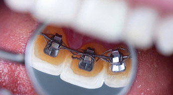 Ortodonta